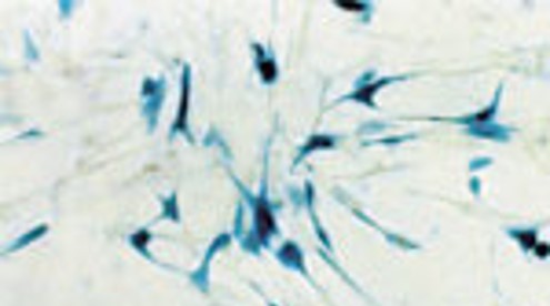 jetPEI™ pour haut débit -Transfection de cellules HeLa exprimant la béta-galactosidase