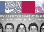 Question/réponse en immunohistochimie (IHC)
