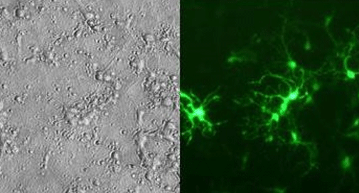 jetMESSENGER™ - transfection d'ARNm dans des cellules difficiles à transfecter